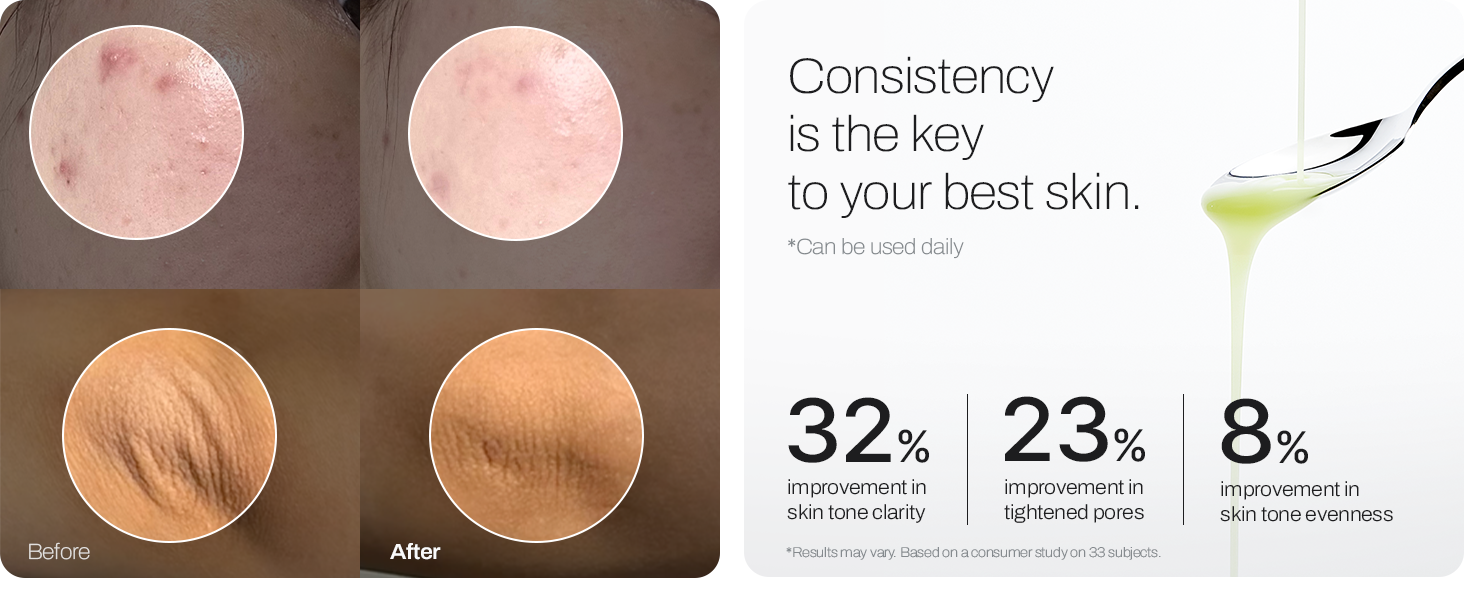 Consistency is the key to your best skin